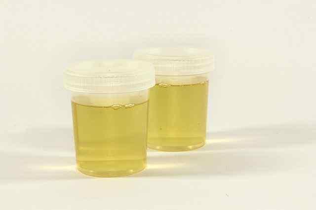 Urine in a glass Jars of urine