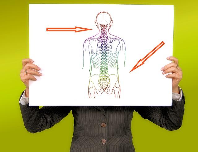 Academic holding up image of Musculoskeletal diagram with arrows