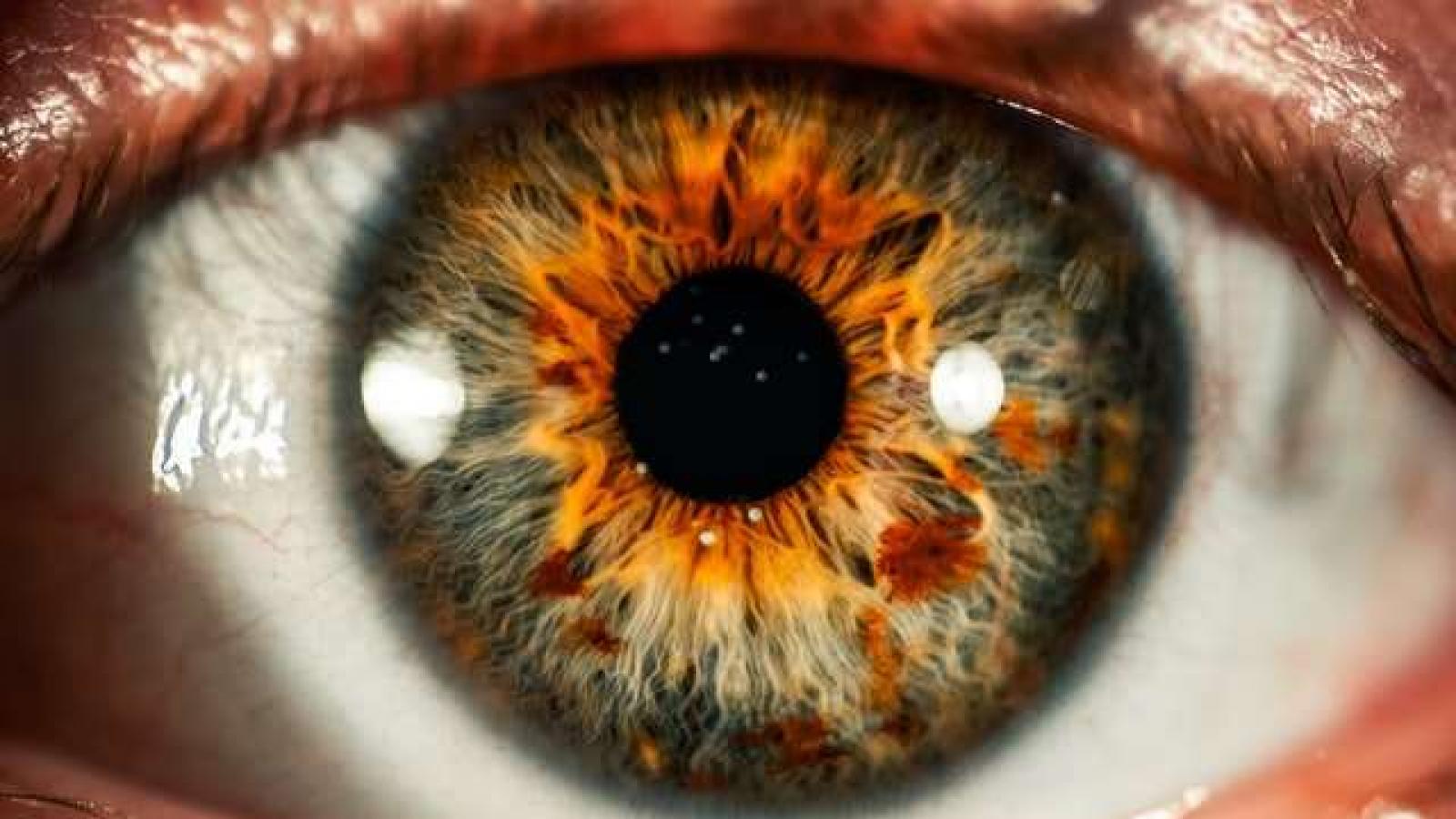 A human eye