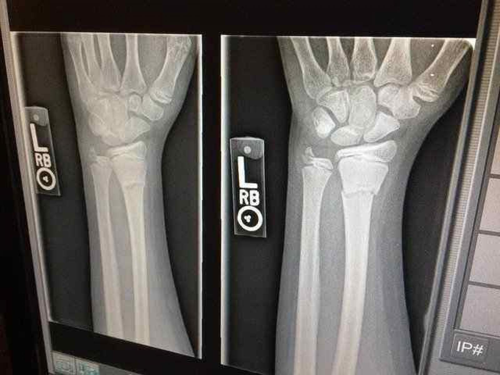 Radioactivity in Medicine An X-ray